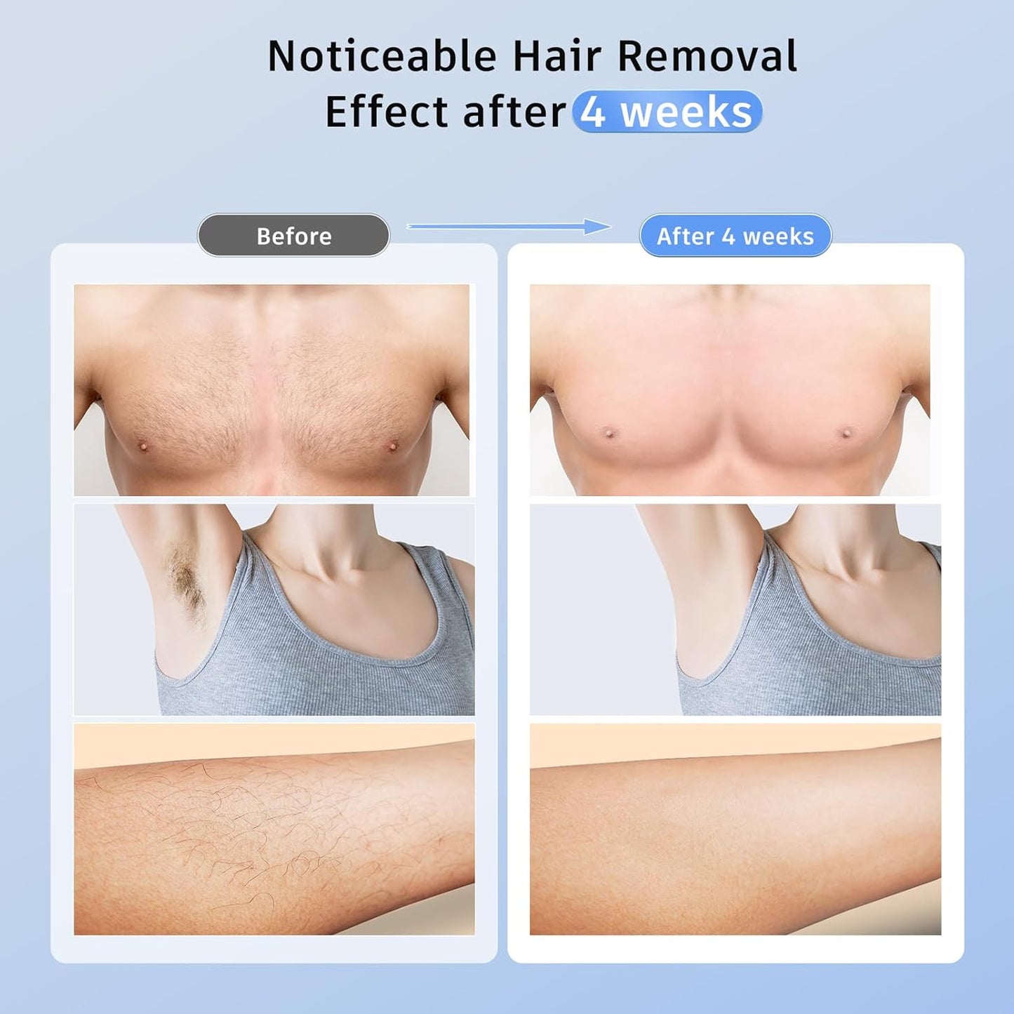 Ubroo IPL Laser Hair Removal – 3-in-1, Ice Cooling, Painless, Gold
